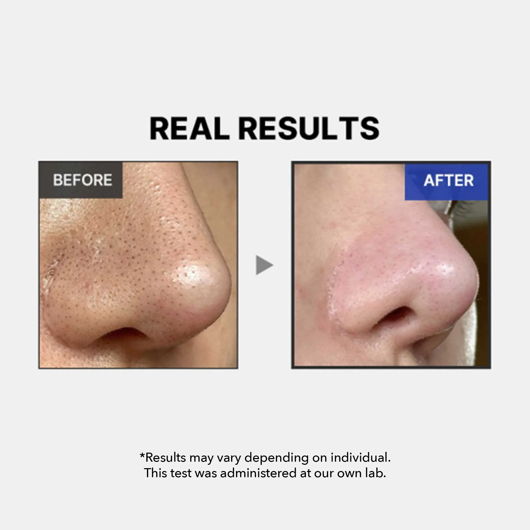 One Day Exosome Shot Pore Ampoule 2000