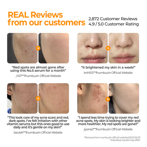 No.5 Goodbye Blemish Brightening Serum
