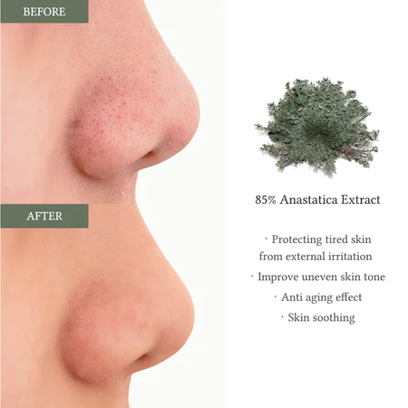 Anastatica Skin Conditioning Toner Pad