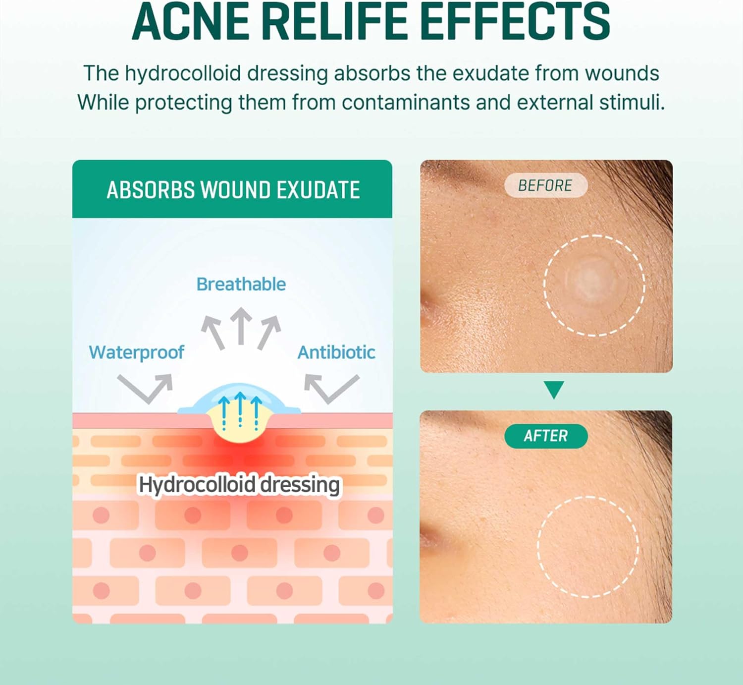 30 Days Miracle Clear Spot Patch (18 patchs)
