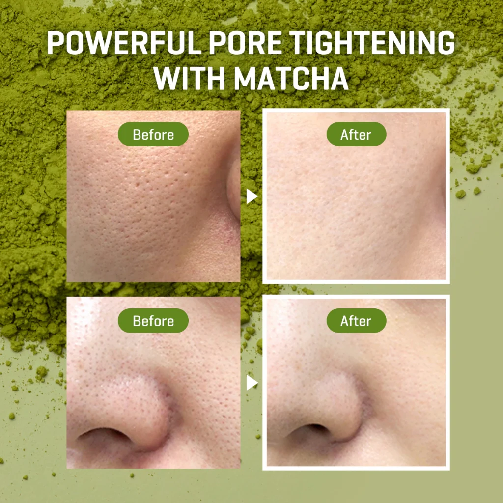 Super Matcha Pore Care Starter Kit (4 soins)