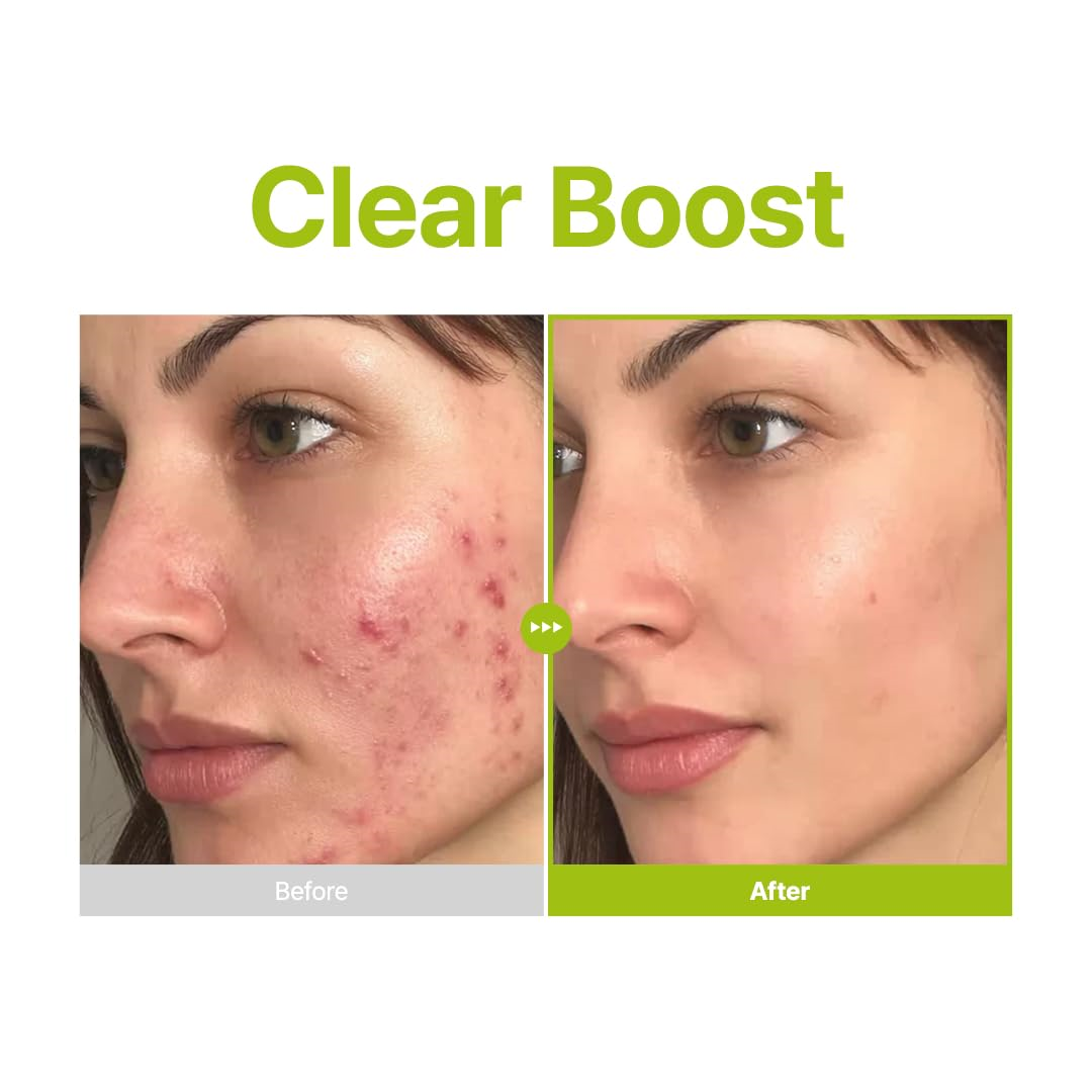 Azelaic Acid 10% Kojic Azulene Serum