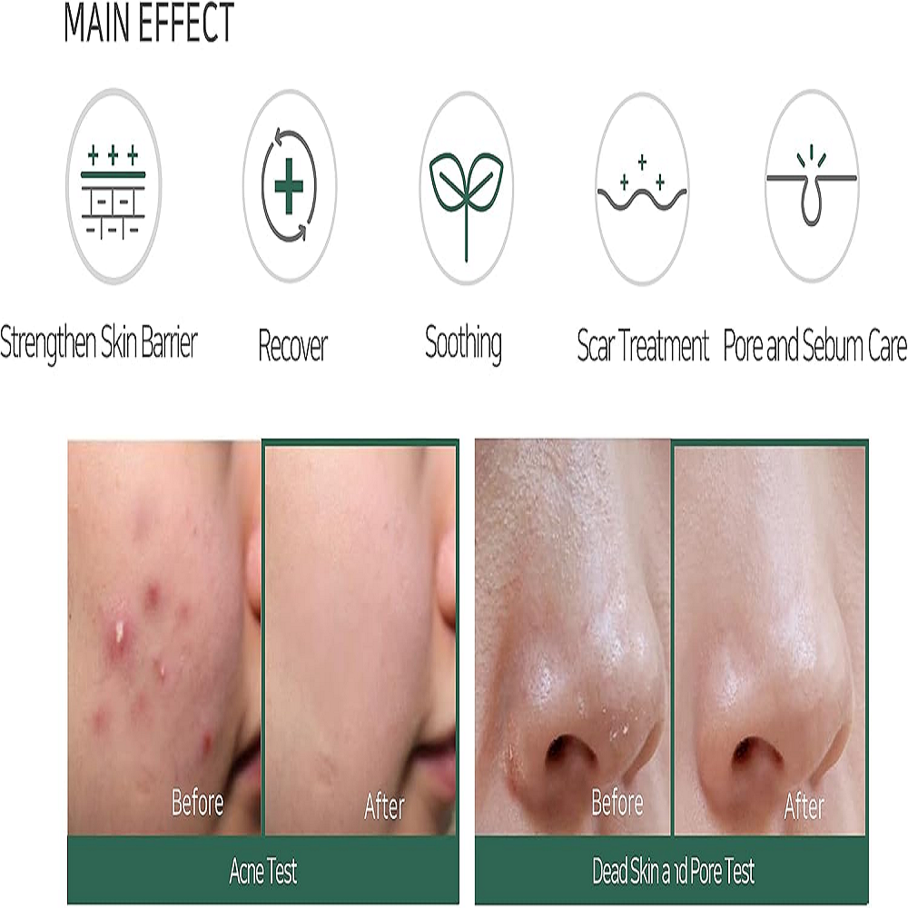 AHA BHA PHA 30 Days Miracle Cream