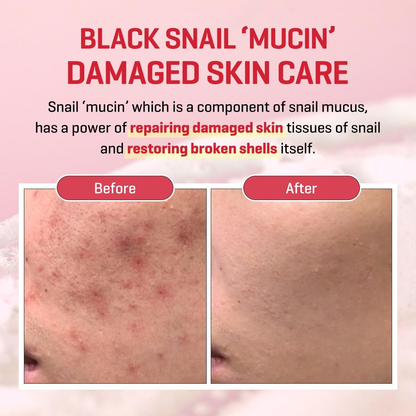 Snail Truecica Miracle Repair Low pH Gel Cleanser