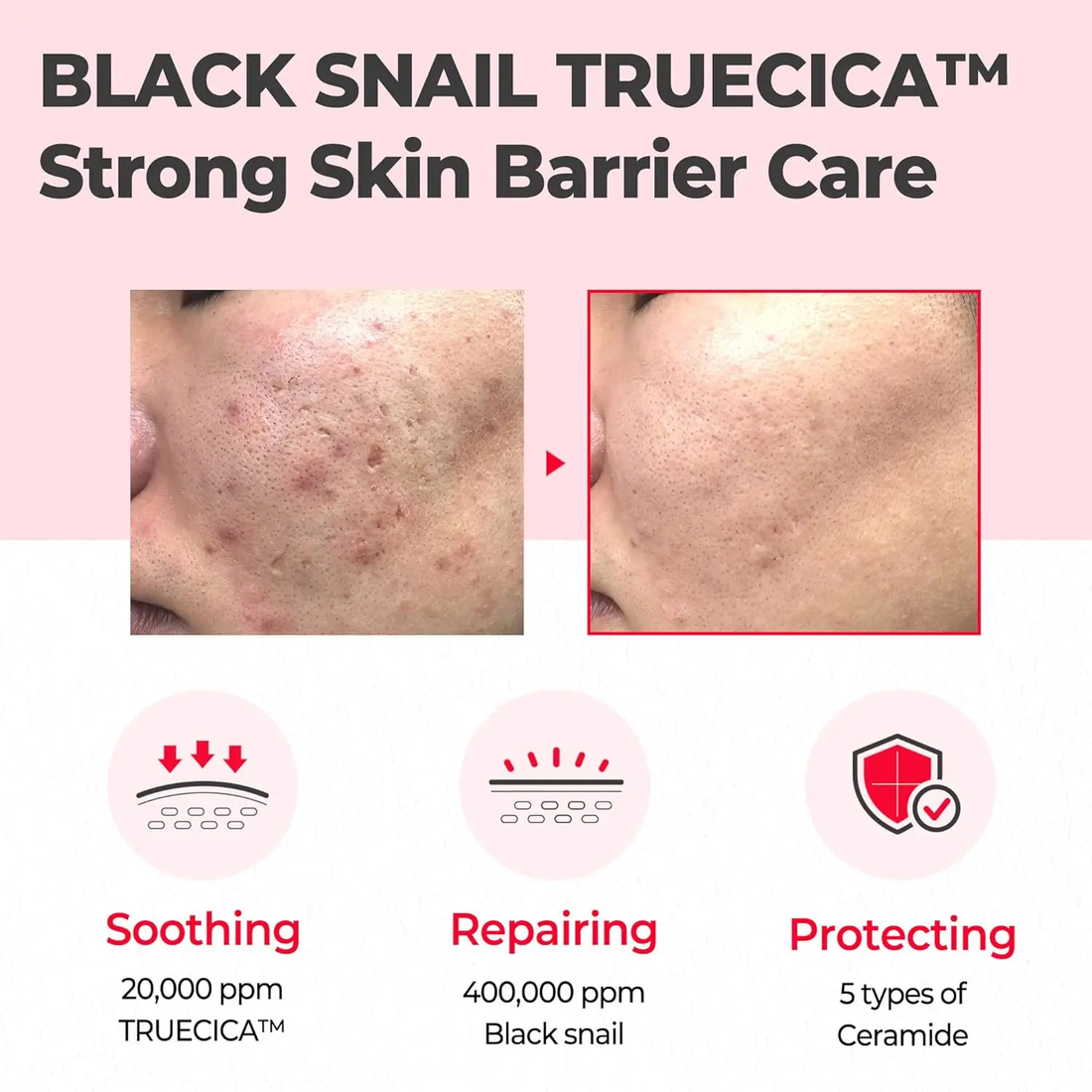 Snail Truecica Miracle Repair Serum