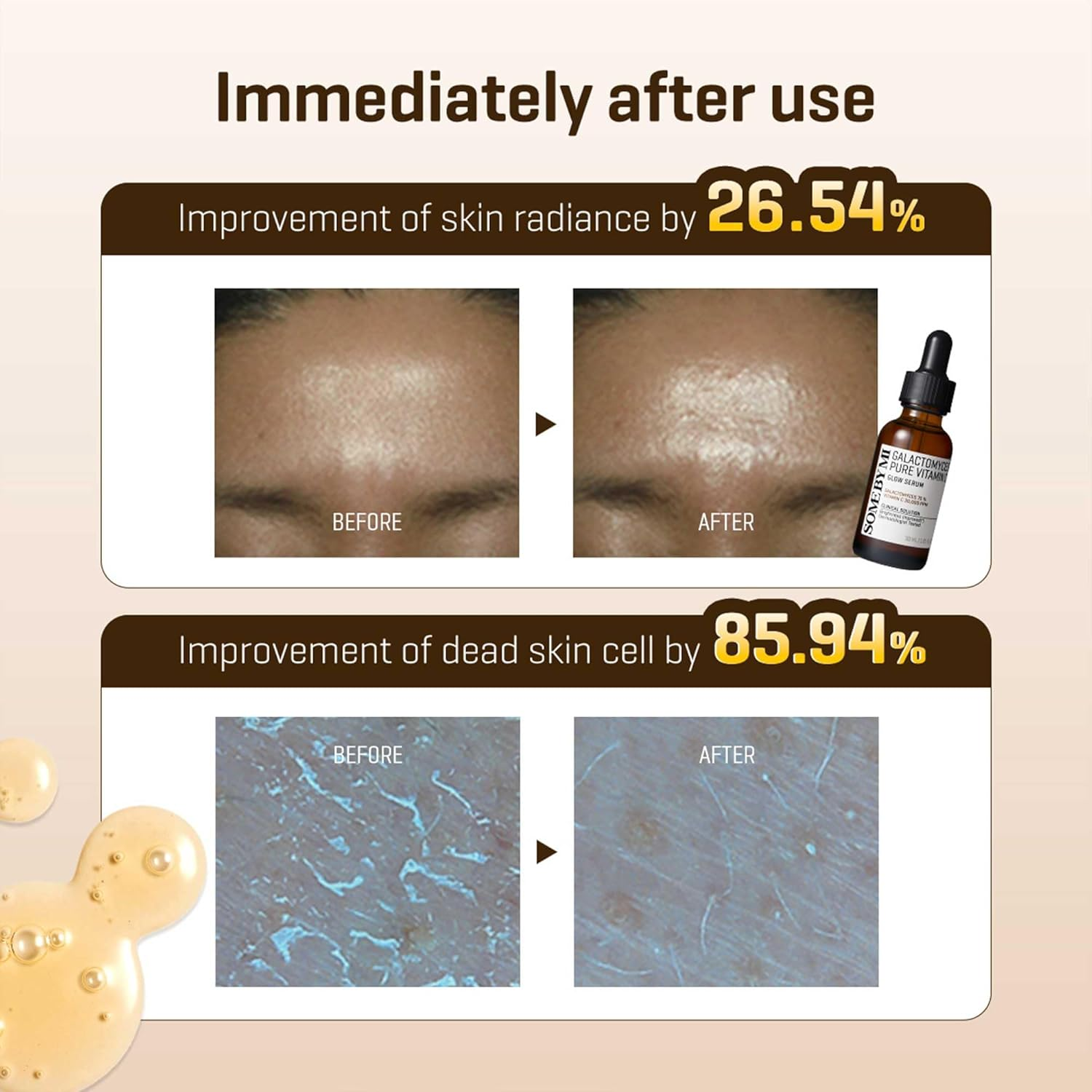Galactomyces Pure Vitamin C Glow Serum